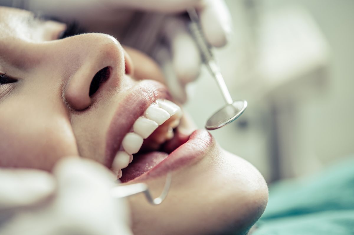dental bonding near you