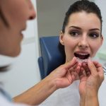 top 7 benefits of using sports guards in sports protect your teeth